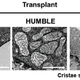 Above, the mitochondria of white, HUMBLE, and brown fat cells, as seen in Tseng and her team’s experiments with mice.